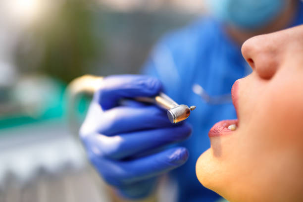 Dental Inlays and Onlays in Port Aransas, TX